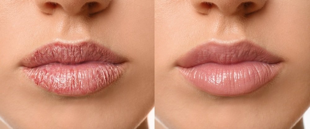 30 10 Makanan yang Bermanfaat Jadi Vitamin Bibir untuk Atasi Kering